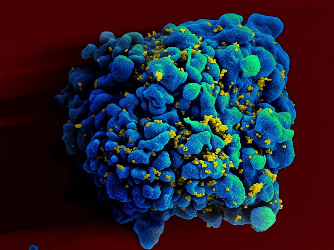 Escaneo electromicrográfico de una célula T infectada con VIH (NIAID)