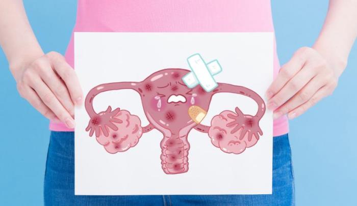 Cancer-cuello-uterino