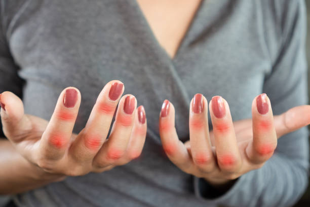 closeup woman suffering from hand and finger pain can be use for knuckle , joint pain and gout concept