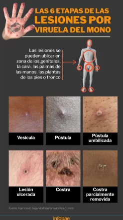 DPGFSG6NQVBX3O3U2ZDB42VANM Diario El Cuco Digital todas las noticias del Valle de Uco DPGFSG6NQVBX3O3U2ZDB42VANM