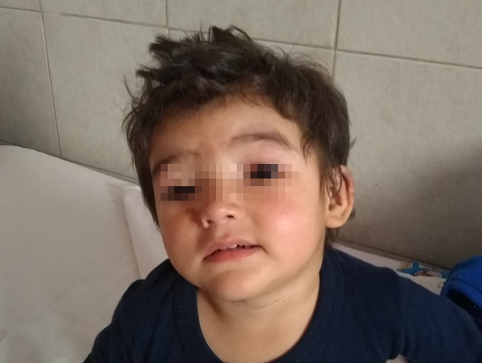 El nene estaba internado en la Ciudad de Mendoza.