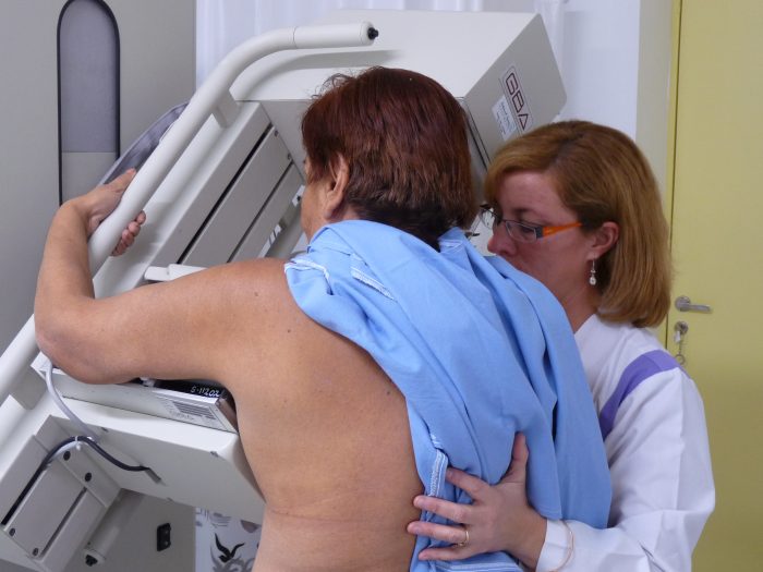equipo-mamografia-1